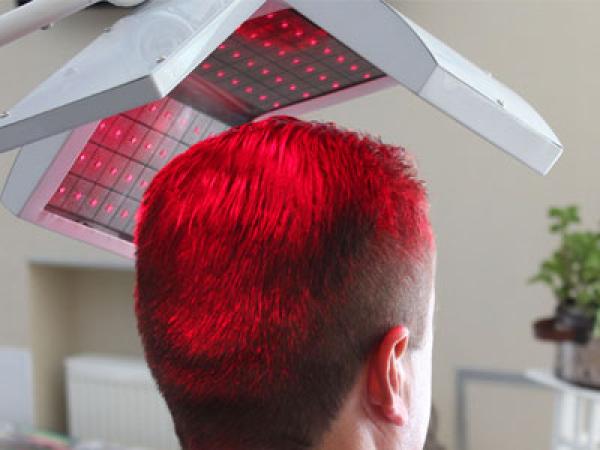 Saç Lazeri Tedavisi